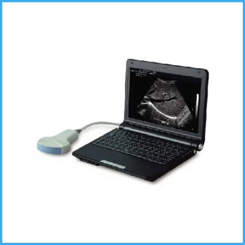 LEO 3000D1 Laptop Ultrasound Scanner 1