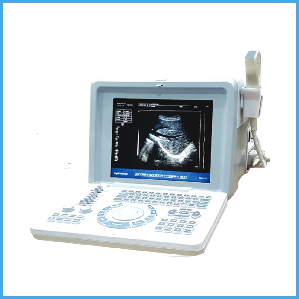 Portable Digital Ultrasound Machine – Oriel Plus - CitiScientific Supply