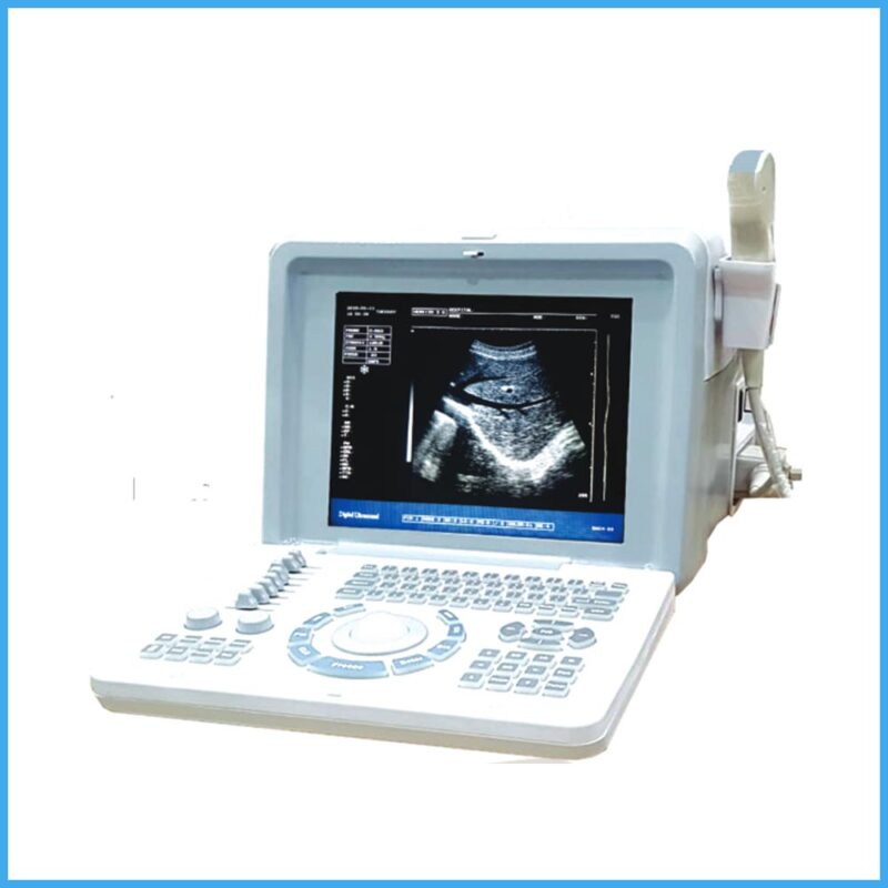 Portable Digital Ultrasound Machine – Oriel Plus