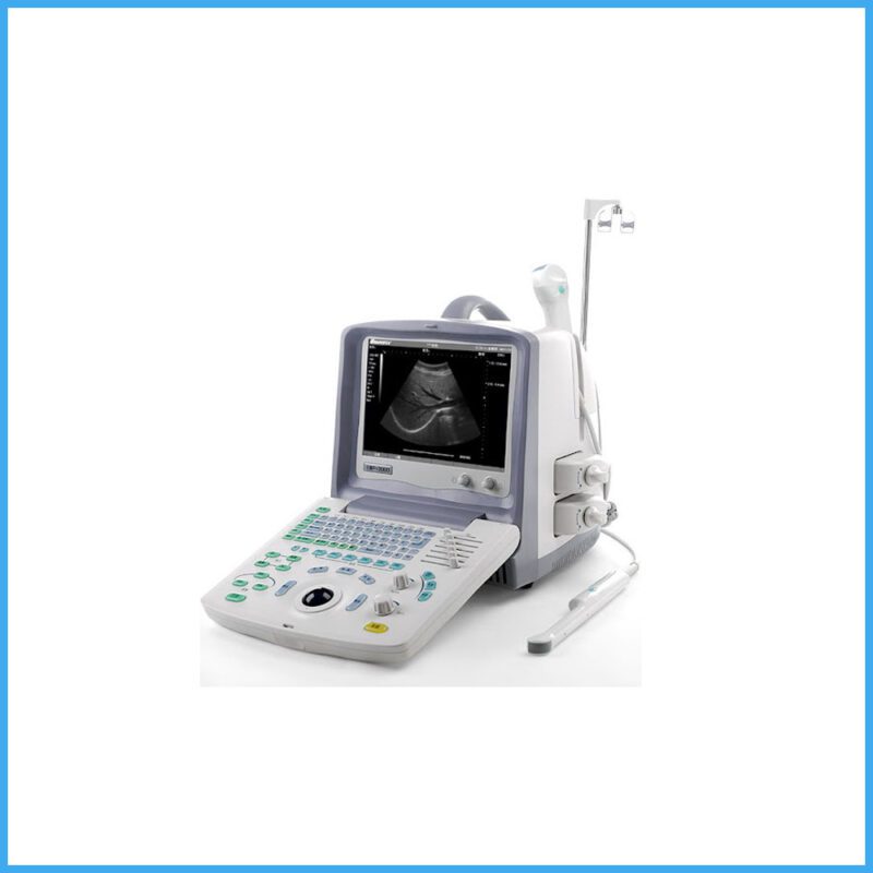 Ultrasound Machine Model Sonovision 2000 China