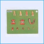CSS 131 Dental Diseases Model