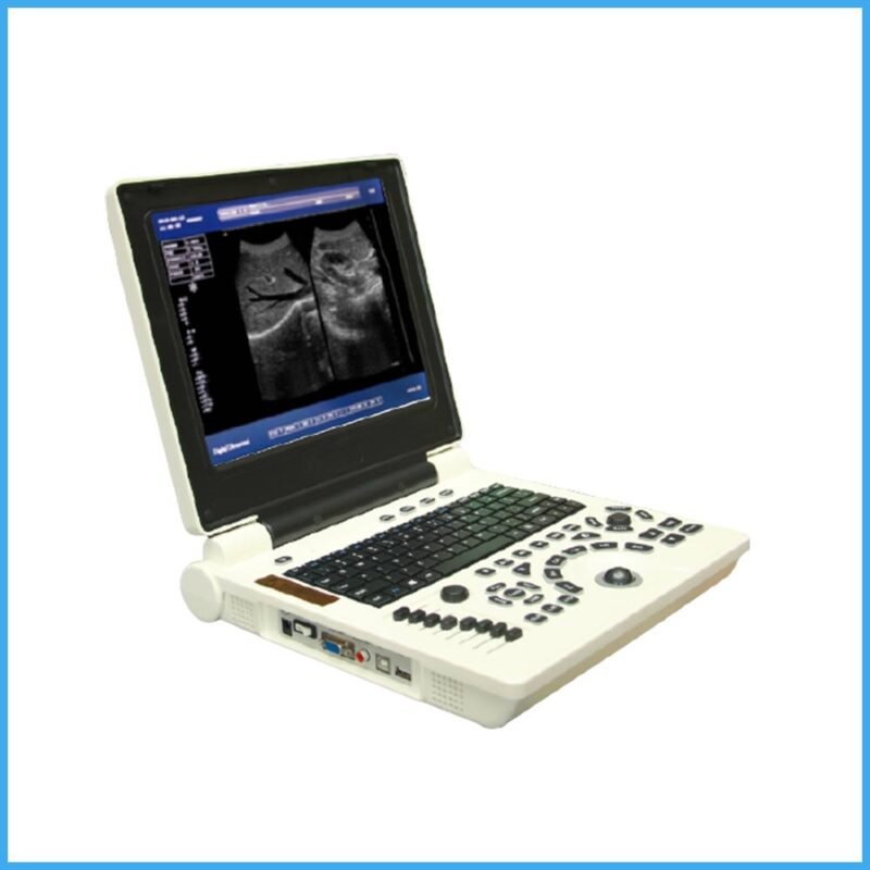 Notebook Ultrasound Machine Oriel Brand - CitiScientific Supply