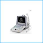 Ultrasound Machine Model Sonovision 2000 China